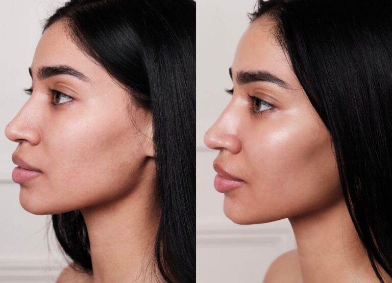 Hydrafacial Deluxe - Facial clinique 00008